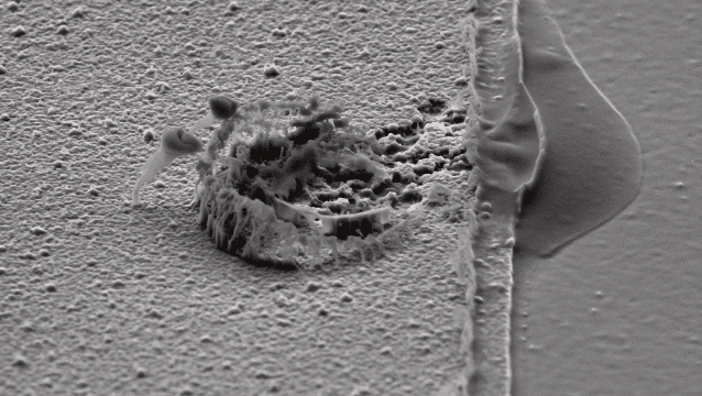 Corrosion on dry-etched Al